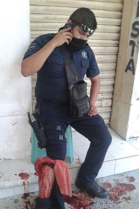 Policía se dispara a sí mismo en el Centro de Acapulco