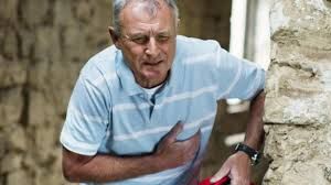 Más del 61% de los episodios de infartos mortales los padecen hombres
