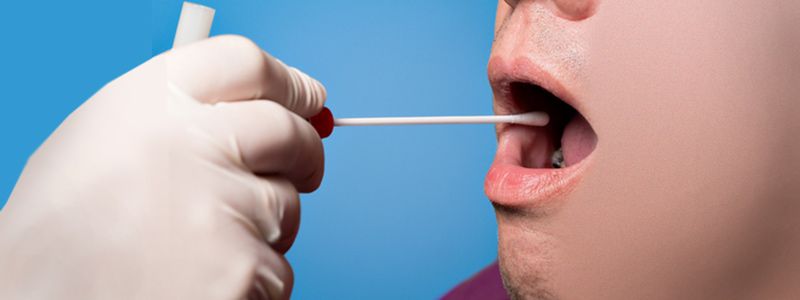 Una gota de saliva para detectar cáncer oral