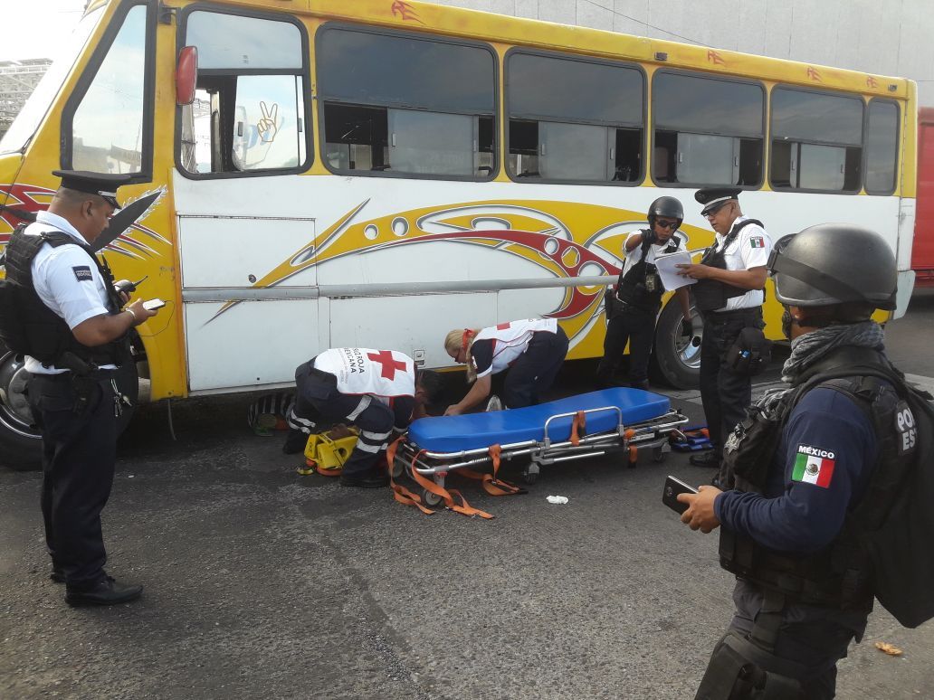 Camión urbano le destroza las piernas a una mujer, en Acapulco