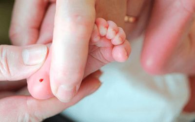 Derechos Humanos exige aplicación del tamiz neonatal garantizada