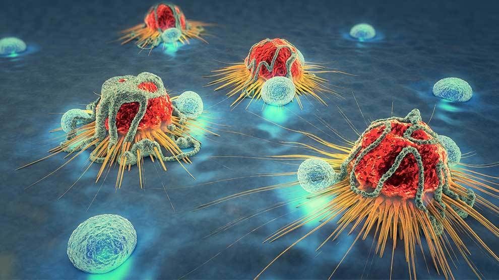 Científicos crean un láser capaz de escanear, detectar y destruir células cancerosas sin extraer muestras
