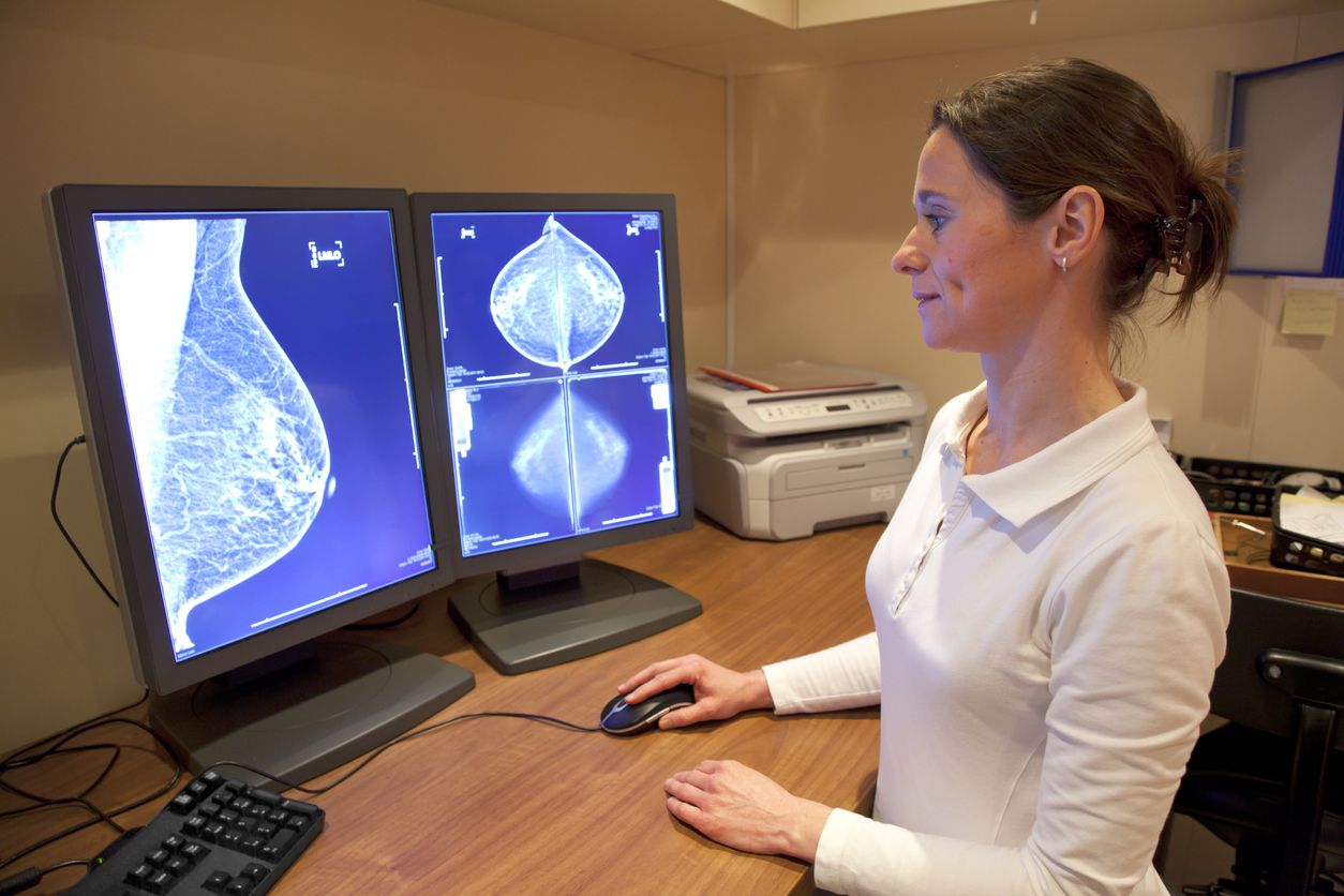 Dispositivo predice cáncer de mama años antes de que aparezca