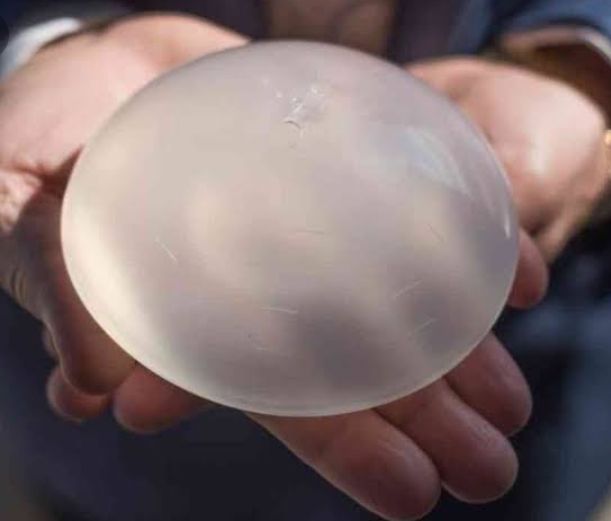 Implantes para senos dejan de ser vendidos por aumentar riesgo de cáncer
