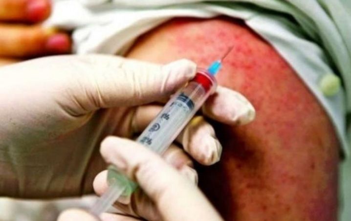 El ISSEM prevenido en casos de sarampión