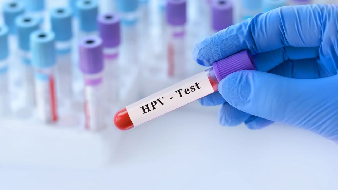 Un 90 % de población podría estar en contacto con el VPH sin saberlo