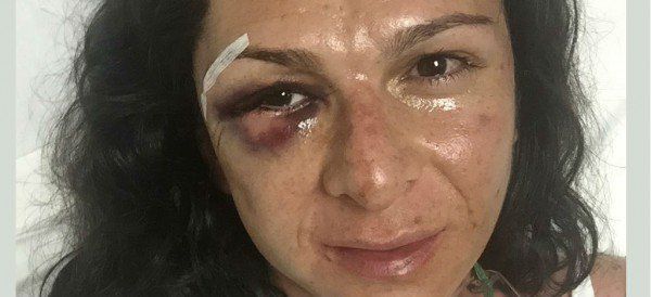 La senadora  y campeona Mundial, Ana Gabriela Guevara sufre accidente en Valle de Bravo