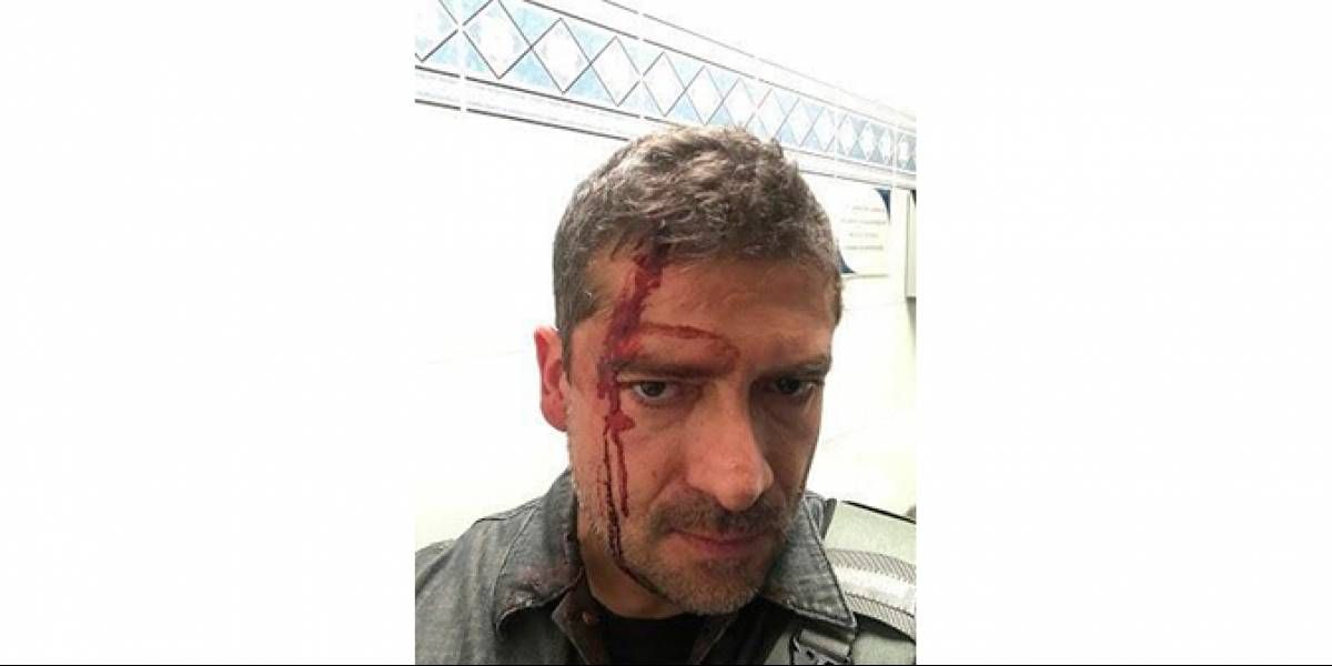 UNAM denuncia ante PGR agresión a reportero
