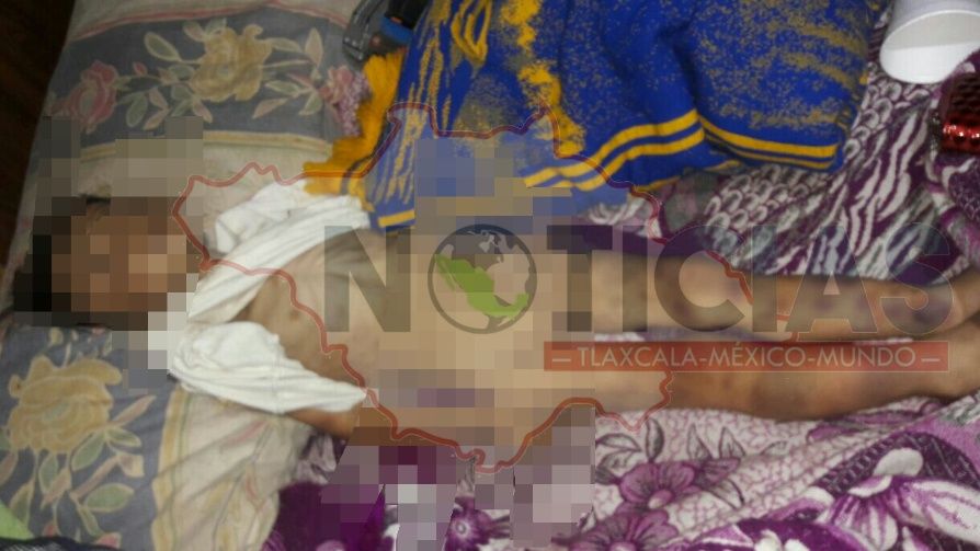 NIÑO ES ENCONTRADO MUERTO CON EQUIMOSIS EN EL CUERPO Y ALTO GRADO DE DESNUTRICIÓN.