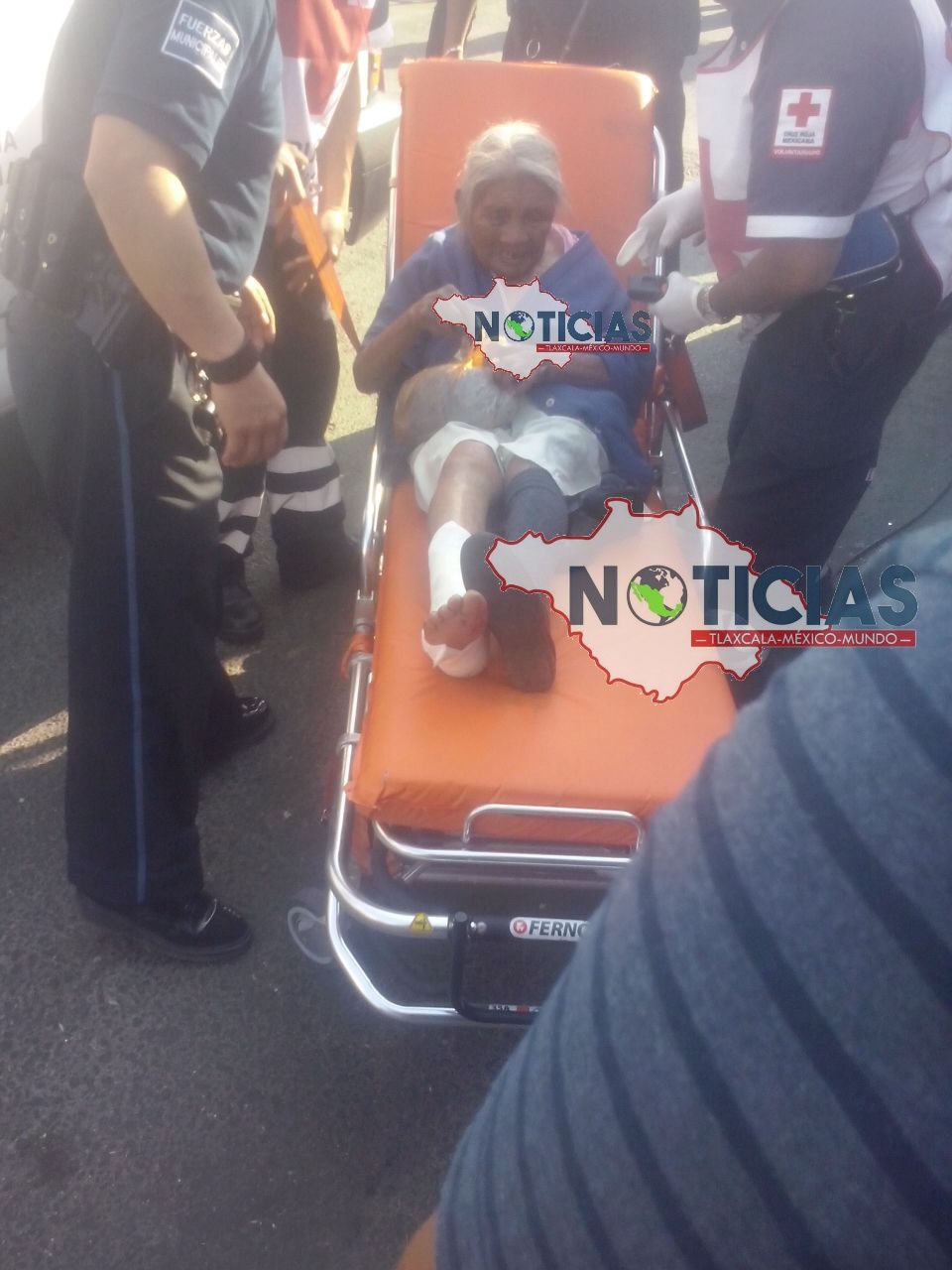 Sufre fractura fémina por colectiva..