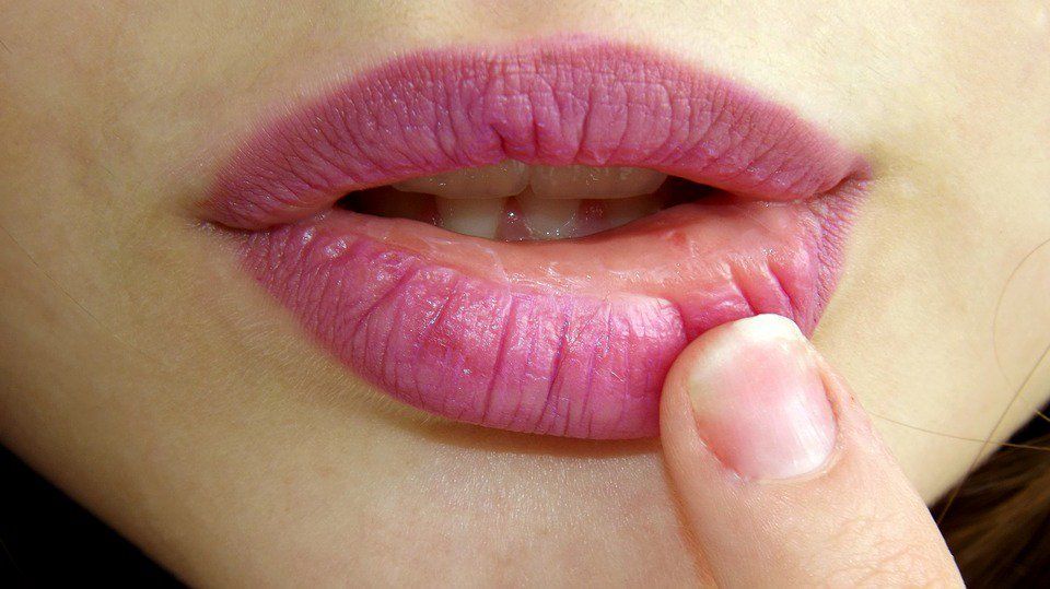 
El estrés y el frío pueden causar herpes labiales
