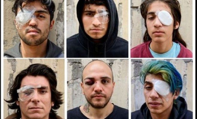 Suman cerca de 400 chilenos los que han querido mutilar de los ojos en protestas 