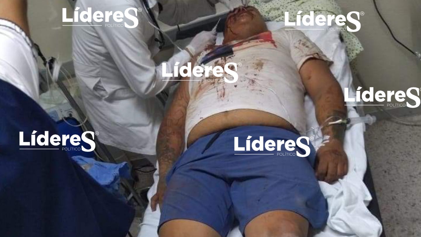 Se eleva a tres el numero de muertos y 7 heridos por riña en balneario El Tephé de  Ixmiquilpan Hidalgo 
