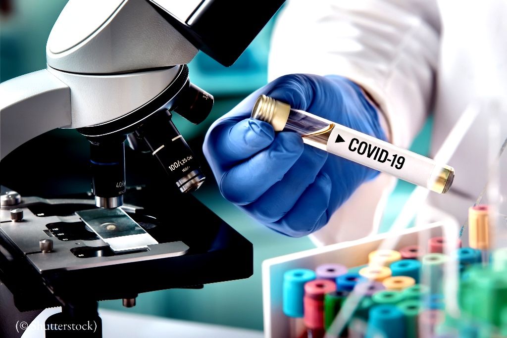El Edoméx registra 34 casos más positivos a COVID-19; SUMAN 354