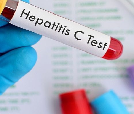 SINALOA CONTRIBUIRÁ EN LA ERRADICACIÓN DE LA HEPATITIS C EN PACIENTES CON VIH/SIDA