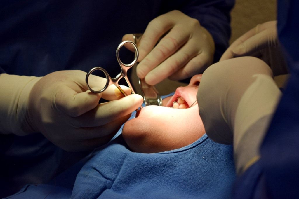El IMIEM devuelva sonrisas a pacientes pediátricos con 3 mil cirugías bucodentales