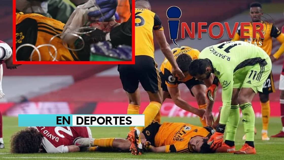 Raúl Jiménez abandona el partido ante el Arsenal inconsciente tras golpe en la cabeza.