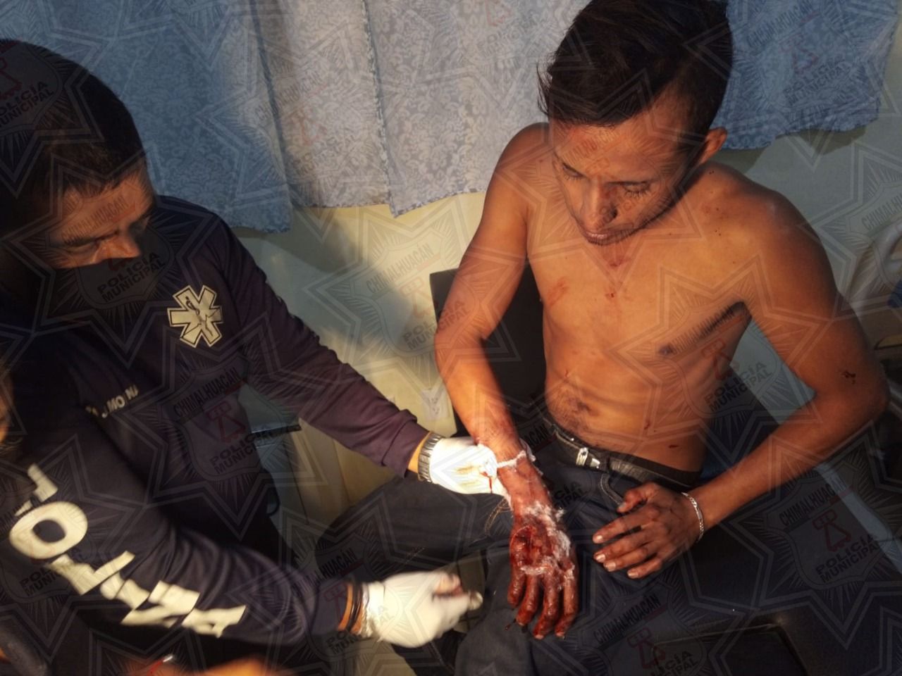 
RM Chimalhuacán auxilió a dos hombres lesionados
