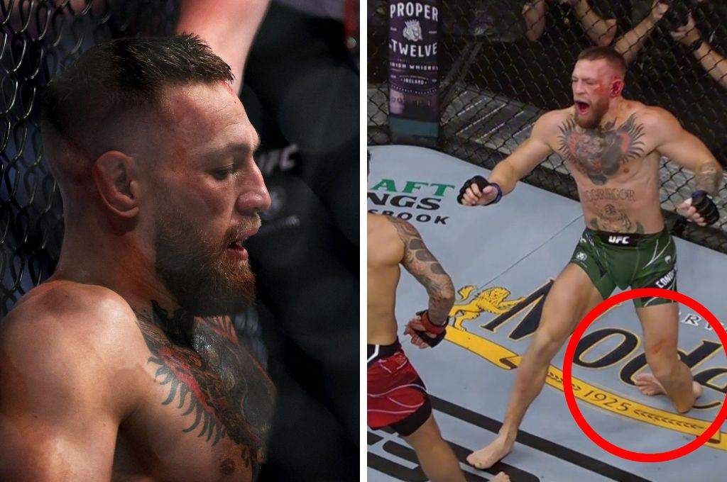Sufre McGregor impactante lesión
