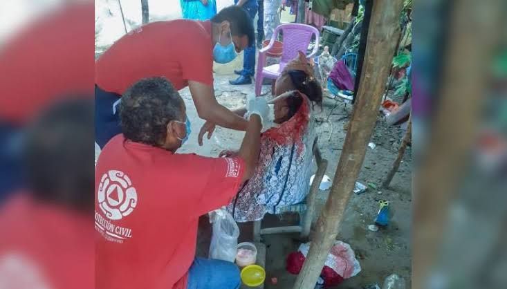 Embarazada es atacada a machetazos por su suegro en Ometepec