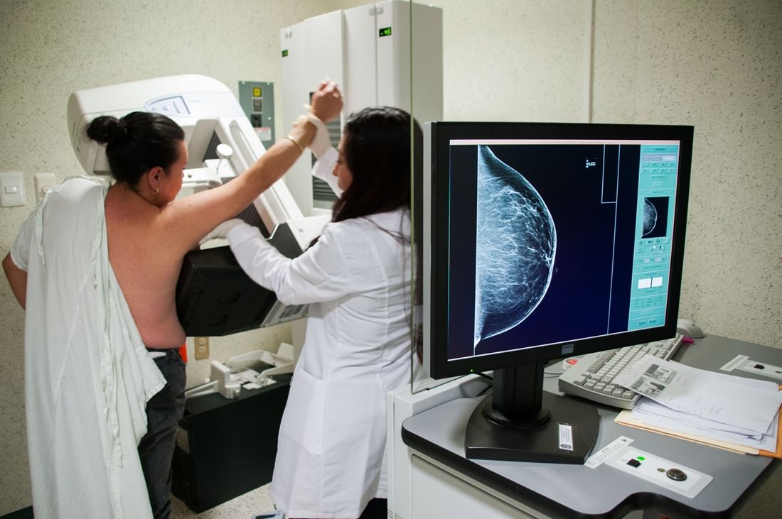 Promueve salud Edoméx detección oportuna de cancer de mama