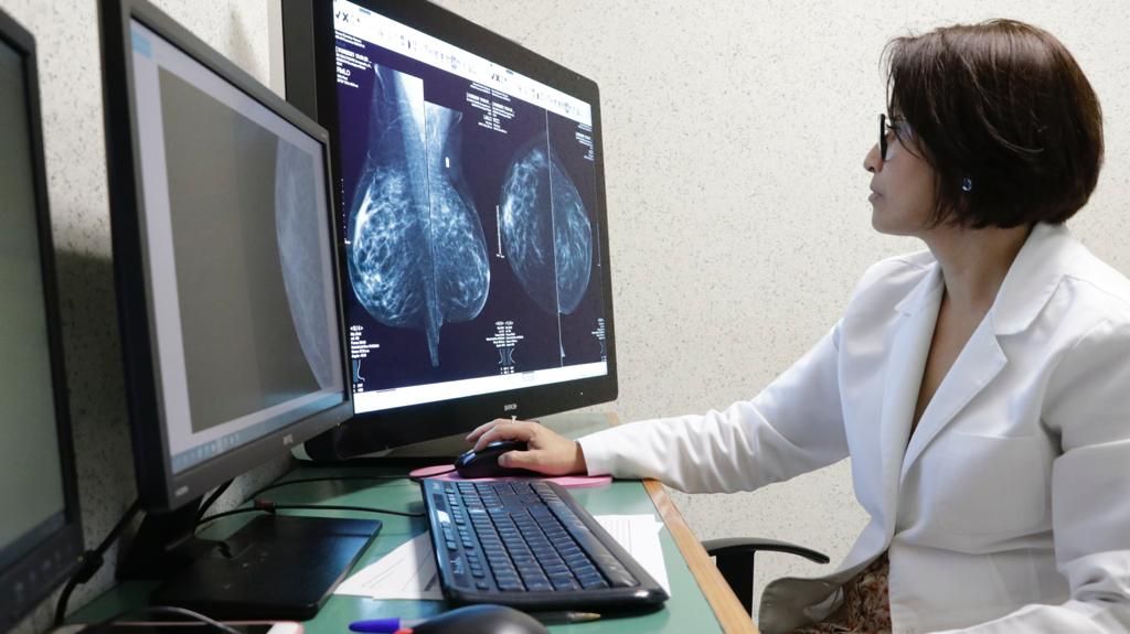 En los casos de cáncer de mama el 40 % llega en etapa cero y 60 % en etapa avanzada