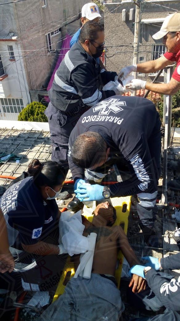 #Policías de Chimalhuacán auxiliaron  a masculino por amputación de extremidad en accidente 