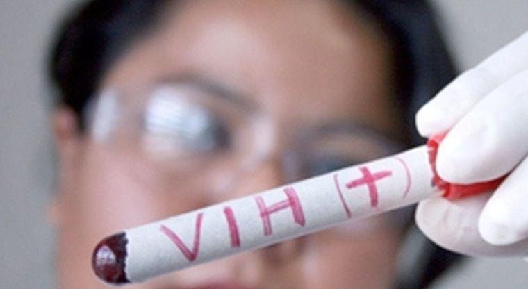 Llama Salud Edoméx a contar con Información confiable para prevenir el VIH-SIDA