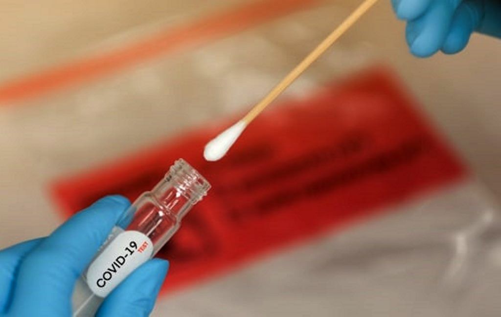 Salud del Edoméx aplica más de 14 mil pruebas en las dos últimas semanas epidemiológicas
