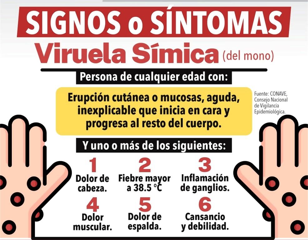 Salud del Edoméx informa de dos casos de viruela símica