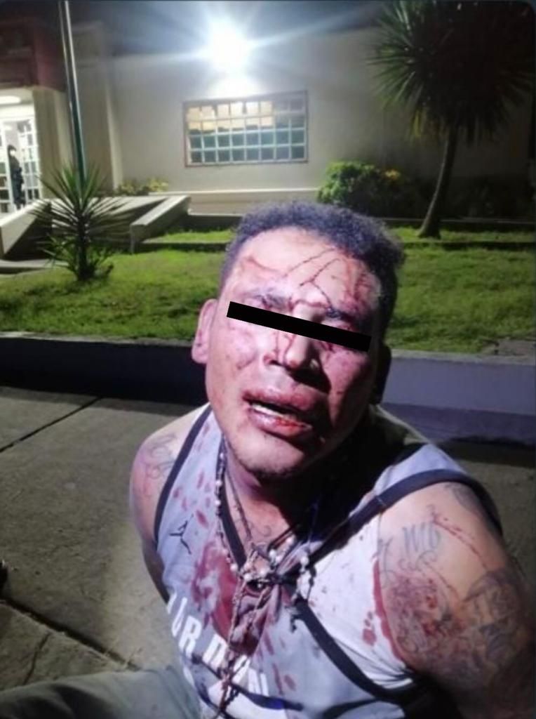 Lesiona a tres con machete en Tecámac; se salva de ser linchado