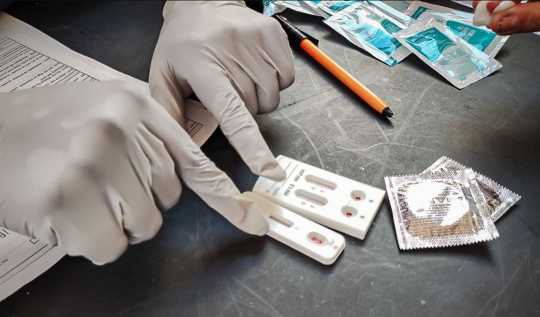 SSH dispone de pruebas de detección rápidas para VIH