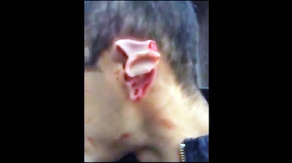 Policía del DF mutila oreja a un automovilista 